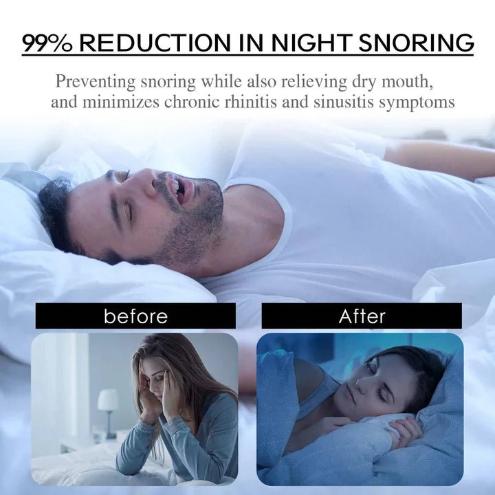 QuietSleep - Anti - Snoring Sleep Mouth Tapes - Kalinzy